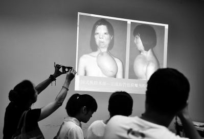 醫(yī)生介紹小梅的病情和治療方式